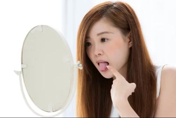 知らないと危険！舌に歯型がつく原因と効果的な対処法を徹底解説【八王子市】