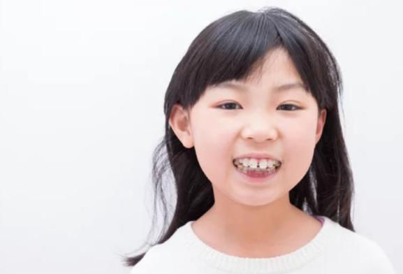 ワイヤーとマウスピースどっちがいい？自分の子どもに合った歯列矯正の見極め方【八王子市】