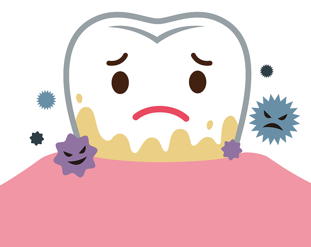 歯磨きだけでは虫歯・歯周病は予防できない！？